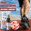 30ml Vericose Vein Spray